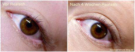 Realash Wimpernserum eyelash Enhancer Vorher Nachher 2