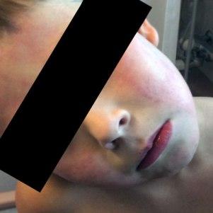 Ist mein Kind Allergie-gefährdet? allergie