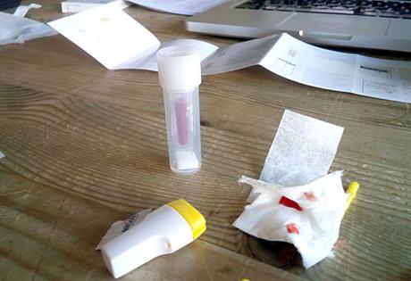 Blut-Blog: Mein Vitamin D-Test
