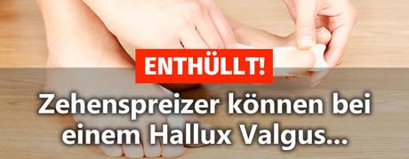 ENTHÜLLT! ▷ Zehenspreizer können bei einem Hallux Valgus… Zehenspreizer Füße
