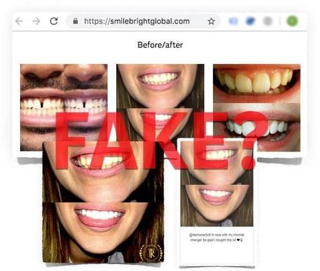smile bright erfahrungsberichte fake bewertungen vorher nachher fotos