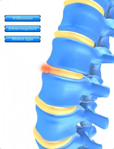 Rückenschmerz Tagebuch – Finde mit der aktuell kostenlosen App die Ursache für deine Schmerzen heraus