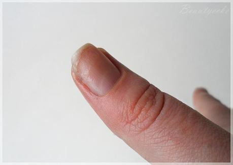 Tipps und Tricks: Wie repariere ich einen eingerissenen Nagel
