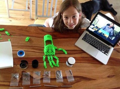 9-year-old-3D-printed-hand
