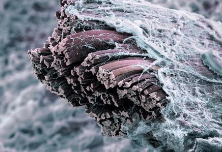 Muskelfasern umgeben von Bindegewebe - den Faszien