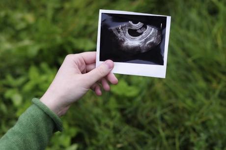 Schwangerschaft verkünden: Alle sollen es wissen!