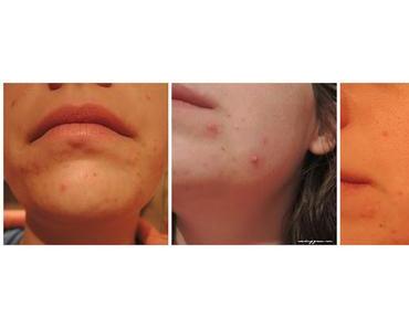 [Skincare] Reizt Du noch oder pflegst Du schon?