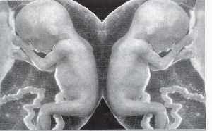 Vom Leben nach der Geburt | Zwillinge | Allegorische Weisheit