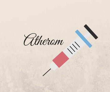 Atherom
