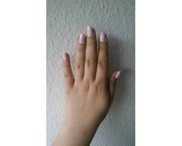 NOTD