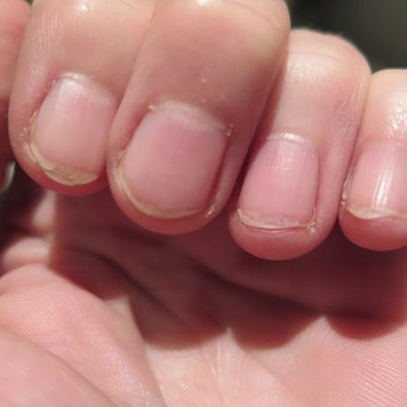 Mein Nagel Experiment