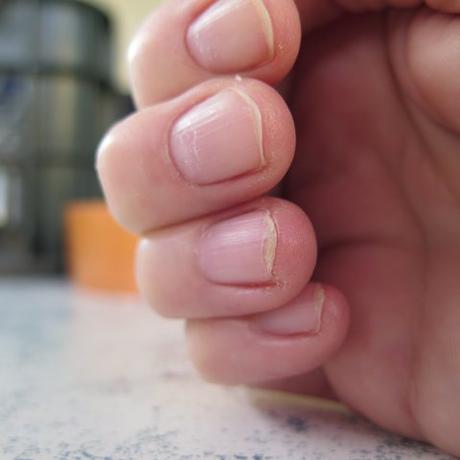 Mein Nagel Experiment