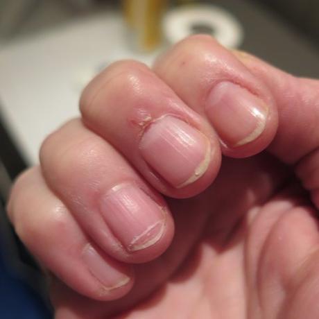 Mein Nagel Experiment