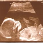 Wie entwickelt sich mein Baby im Verlauf der Schwangerschaft? - dies ist die spannende Frage, die werdende Mütter beschäftigt