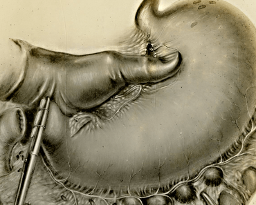 Blogbuster 2017 – „Das Magenkomplott“ geht ins Rennen