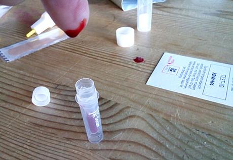 Blut-Blog: Mein Vitamin D-Test