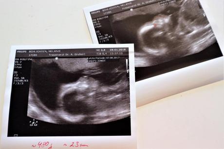 Schwangerschaft #3 (14-23 Woche)