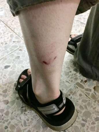 Ein Hundebiss in Thailand