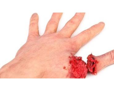 Mahlzeit – Daumen ab