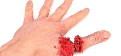 Mahlzeit – Daumen ab