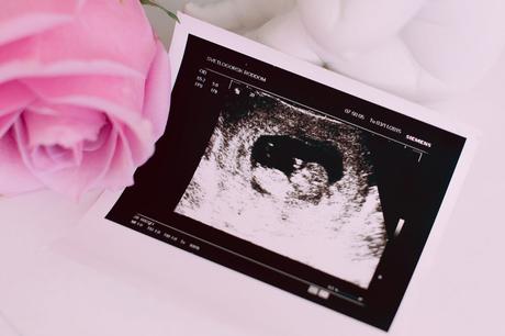 Wie du schon beim ERSTEN Ultraschall das Geschlecht deines Babys erfahren kannst!