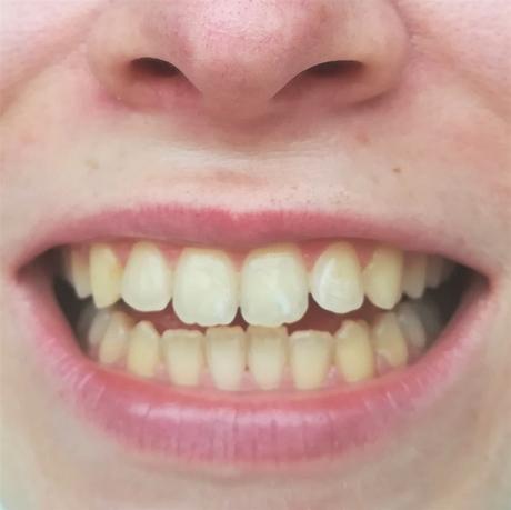 [Werbung] Mara Expert Aktivkohle Plus Sensitiv Zahncreme
