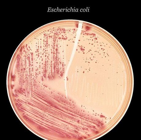 File:Escherichia coli (MCC).jpg