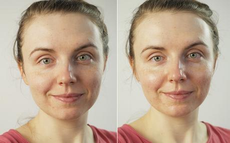 Babydream Med+ Gesichtscreme auf Haut
