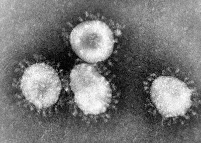 Infektion mit neuen Coronaviren verläuft großteils harmlos