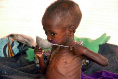 Die Dürre und der Mangel an Nahrung trifft die Kleinsten am schlimmsten.