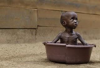 Somalia: Kindersterblichkeit infolge Hungersnot erschreckend hoch