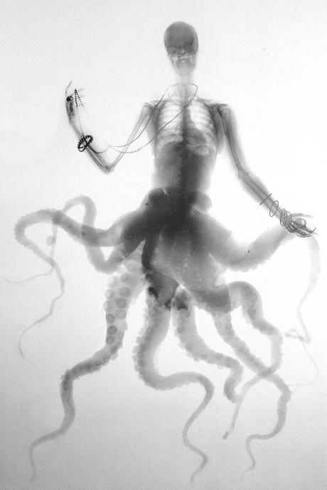 Benedetta Bonichi: X-Ray Art