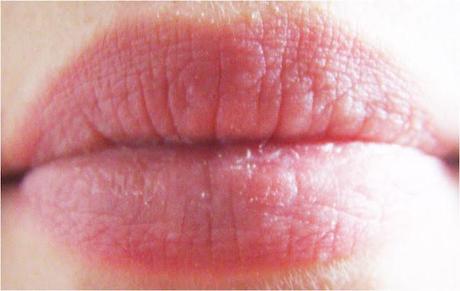 [106] Wie bekommt man vollere Lippen?