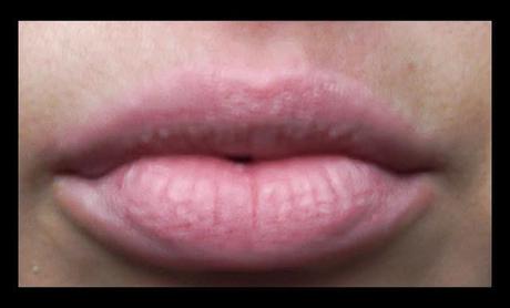 Artdeco Lifting Lip Stylo - Lippenbase