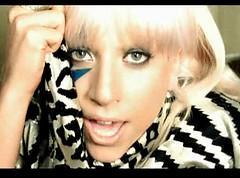 Lady Gaga: Gehirnerschütterung durch Konzertunfall