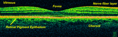 In-vivo-OCT-Scan einer Retina bei 800 nm und einer axialen Auflösung von 3 µm