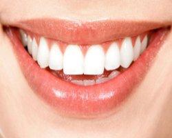 Zahnerosion - Abbau von Zahnschmelz vermeiden