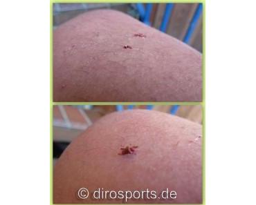 Locker zurück auf die Piste – Gesundheit geht vor