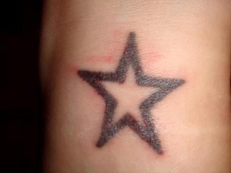 Tattooentfernung mittels Laser - mein Erfahrungsbericht