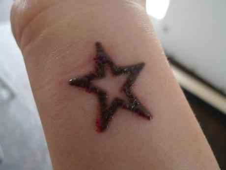Tattooentfernung mittels Laser - mein Erfahrungsbericht