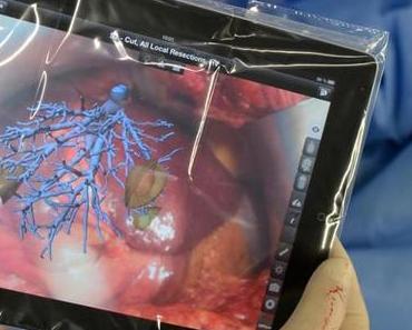 App für Leber-OP: Stehen Ärzte bald mit iPad am OP-Tisch?
