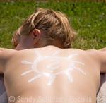 Sonnenbrand Sonnenschutz UV Schutz Hautkrebs Homöopathie Berlin