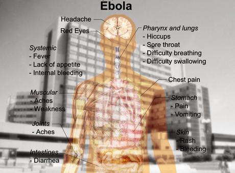 Ebola sorgt für Chaos in Madrid und kostet Excalibur das Leben