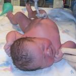 Auspulsieren der Nabelschnur kann sich potentiell positiv auf die Gesundheit des Babys auswirken
