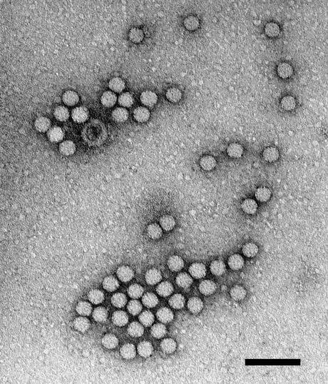 Norovirus Bild vom RKI