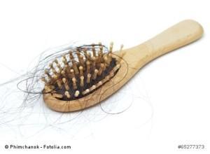 Arten von Haarausfall